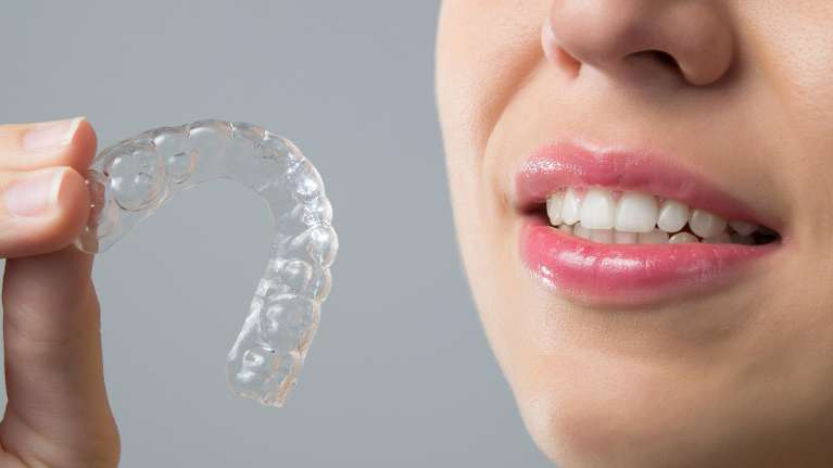 woman holding an aligner