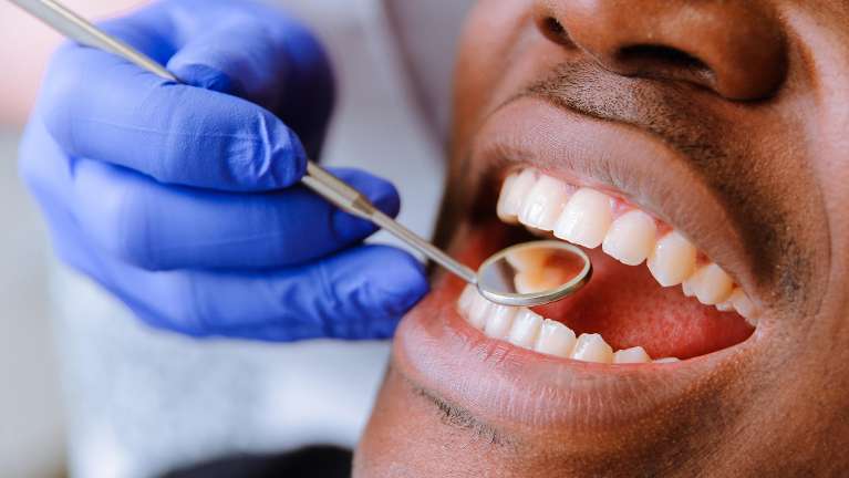 Close up of patient during exam at dentist in Bellevue, NE
